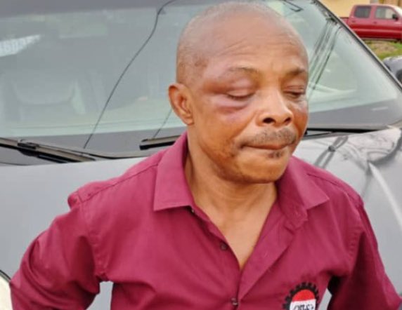 NLC leader’s brutality: NHRC’s boss Ojukwu demands perpetrators be brought to justice