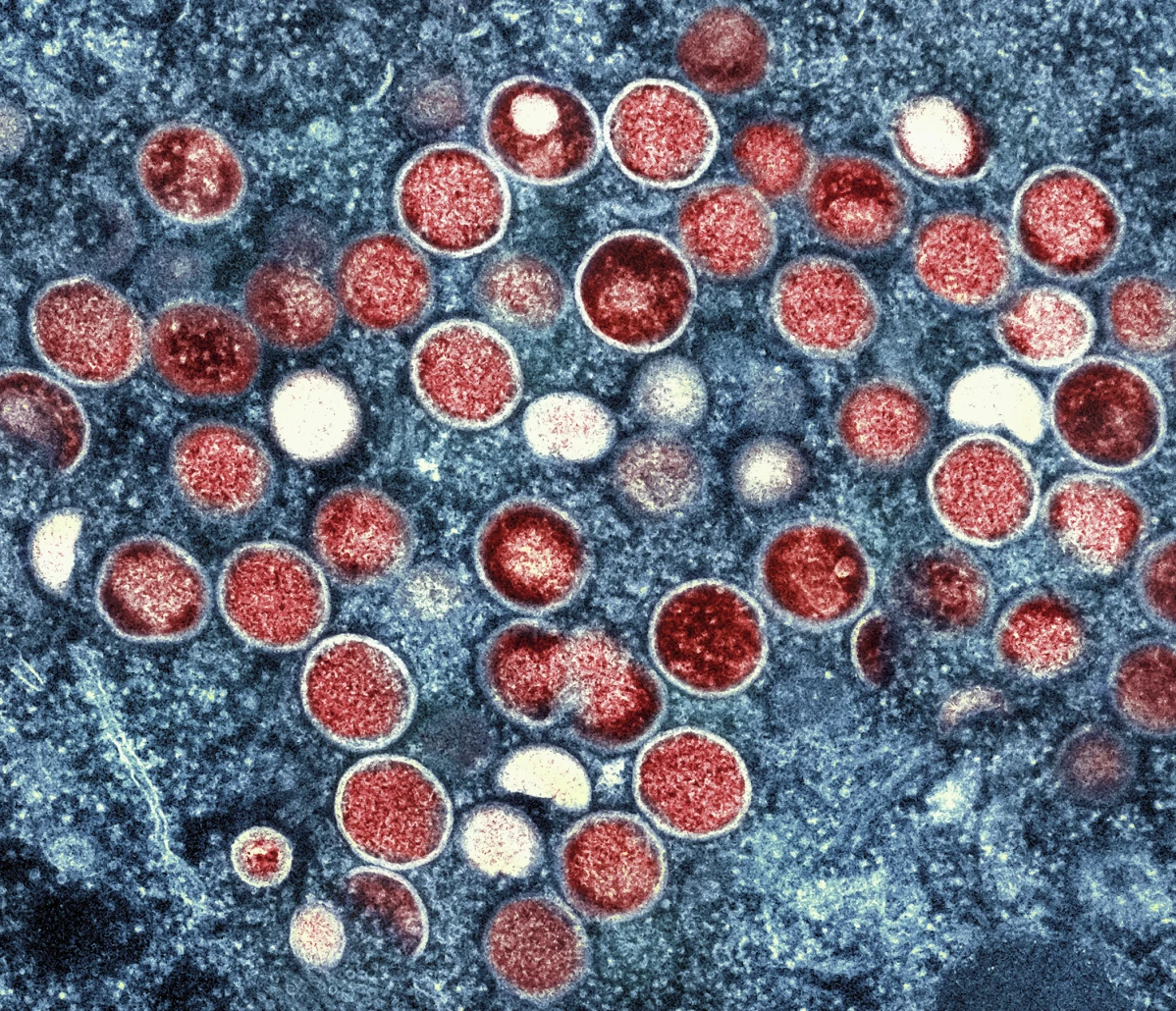 Will Mpox trigger another pandemic, now that it is a global health emergency?