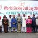 Nigeria Reaffirms Commitment to Bridging Sickle Cell Care Gap, Expands Diagnosis and Treatment Access