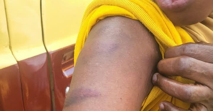 Oyo Police Probe Fatal Attack on Oriyomi Hamzat’s Welcoming Party in Ibadan